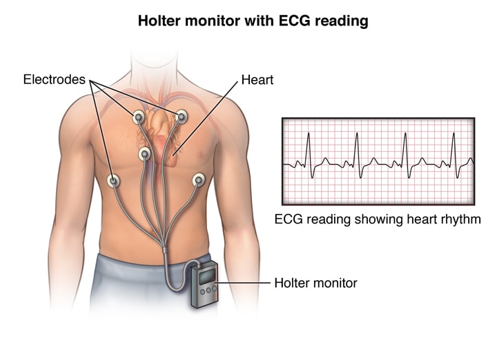 holtermonitor-min